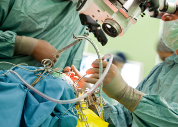 doctors performing brain surgery with microscope