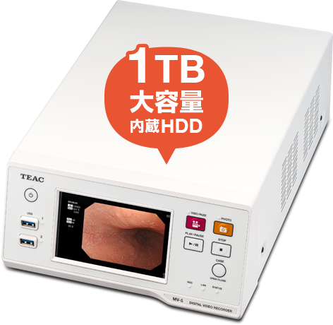 1TB大容量内蔵HDD