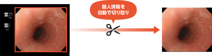 個人情報を自動で切り取り