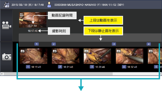 手術内の動画・静止画一括表示